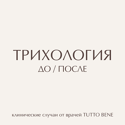Когда перхоть - это не просто перхоть?
