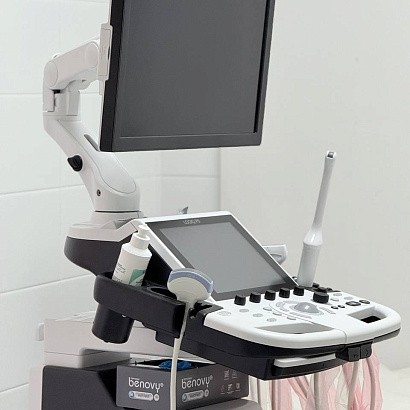 Новинка: аппарат УЗИ LOGIQ P9