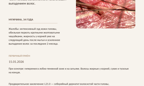 Когда перхоть - это не просто перхоть?
